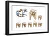Anatomy of Acromioclavicular Joint Rupture and Displacement-null-Framed Art Print