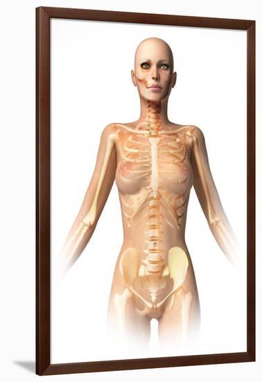 Anatomy of Female Body with Bone Skeleton Superimposed-null-Framed Art Print