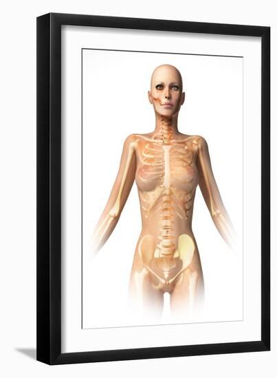 Anatomy of Female Body with Bone Skeleton Superimposed-null-Framed Art Print