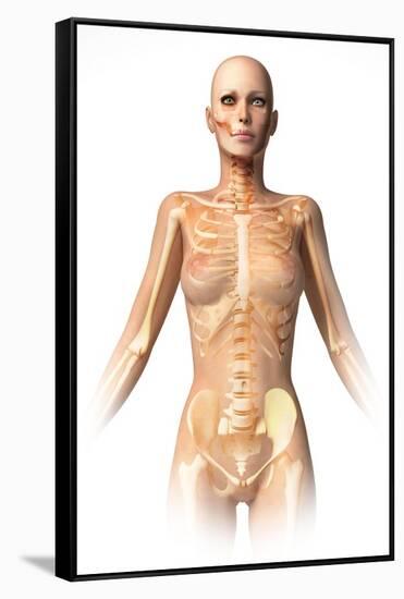 Anatomy of Female Body with Bone Skeleton Superimposed-null-Framed Stretched Canvas