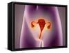 Anatomy of Female Body with Uterus-null-Framed Stretched Canvas