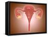 Anatomy of Female Uterus with Ovaries-null-Framed Stretched Canvas
