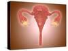 Anatomy of Female Uterus with Ovaries-null-Stretched Canvas