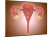 Anatomy of Female Uterus with Ovaries-null-Mounted Art Print