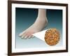 Anatomy of Foot Fungus with Microscopic Close-Up-null-Framed Art Print