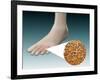 Anatomy of Foot Fungus with Microscopic Close-Up-null-Framed Art Print