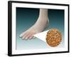 Anatomy of Foot Fungus with Microscopic Close-Up-null-Framed Art Print