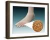 Anatomy of Foot Fungus with Microscopic Close-Up-null-Framed Art Print