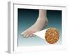 Anatomy of Foot Fungus with Microscopic Close-Up-null-Framed Art Print