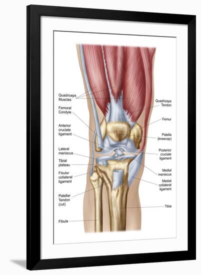 Anatomy of Human Knee Joint-null-Framed Art Print