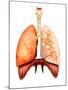 Anatomy of Human Respiratory System, Front View-Stocktrek Images-Mounted Premium Photographic Print