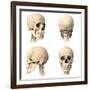 Anatomy of Human Skull from Different Angles-null-Framed Art Print