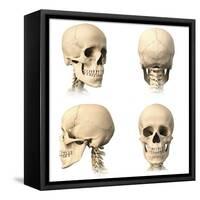 Anatomy of Human Skull from Different Angles-null-Framed Stretched Canvas