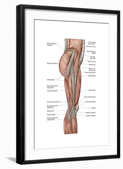 Anatomy of Human Thigh Muscles, Anterior View-null-Framed Art Print