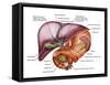 Anatomy of Liver, Antero-visceral View-Stocktrek Images-Framed Stretched Canvas