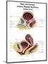 Anatomy of Male and Female Urinary Bladder, with Labels-Stocktrek Images-Mounted Art Print