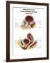 Anatomy of Male and Female Urinary Bladder, with Labels-Stocktrek Images-Framed Art Print