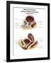 Anatomy of Male and Female Urinary Bladder, with Labels-Stocktrek Images-Framed Art Print