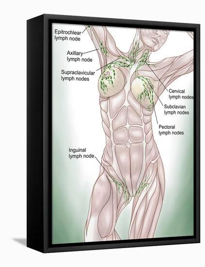 Anatomy of Superficial (Surface) Lymphatics-Stocktrek Images-Framed Stretched Canvas