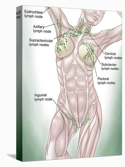 Anatomy of Superficial (Surface) Lymphatics-Stocktrek Images-Stretched Canvas