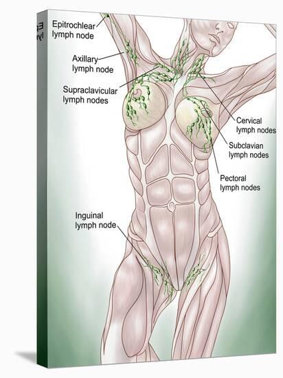 Anatomy of Superficial (Surface) Lymphatics-Stocktrek Images-Stretched Canvas