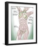 Anatomy of Superficial (Surface) Lymphatics-Stocktrek Images-Framed Premium Photographic Print