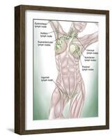 Anatomy of Superficial (Surface) Lymphatics-Stocktrek Images-Framed Photographic Print