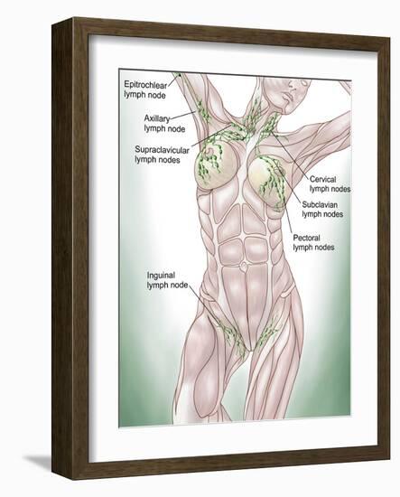 Anatomy of Superficial (Surface) Lymphatics-Stocktrek Images-Framed Photographic Print