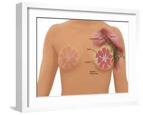 Anatomy of the Breast-Gwen Shockey-Framed Giclee Print