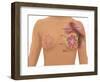 Anatomy of the Breast-Gwen Shockey-Framed Giclee Print