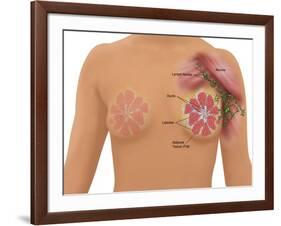 Anatomy of the Breast-Gwen Shockey-Framed Giclee Print