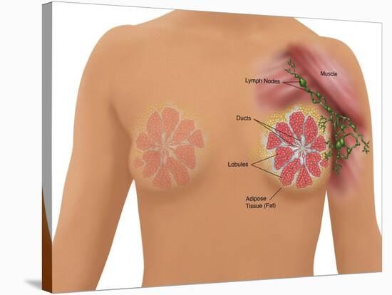 Anatomy of the Breast-Gwen Shockey-Stretched Canvas