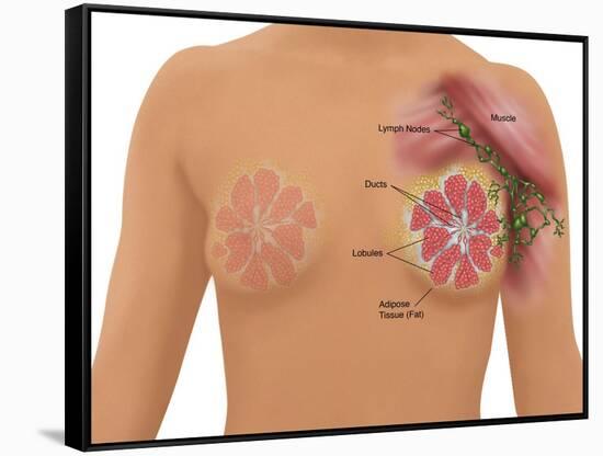 Anatomy of the Breast-Gwen Shockey-Framed Stretched Canvas