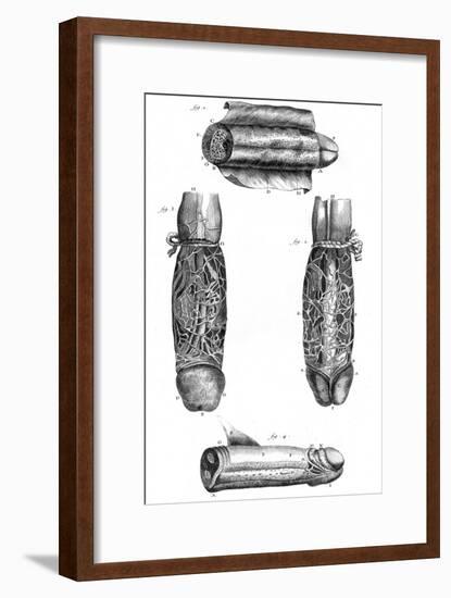 Anatomy, Penis 18th C.-null-Framed Art Print