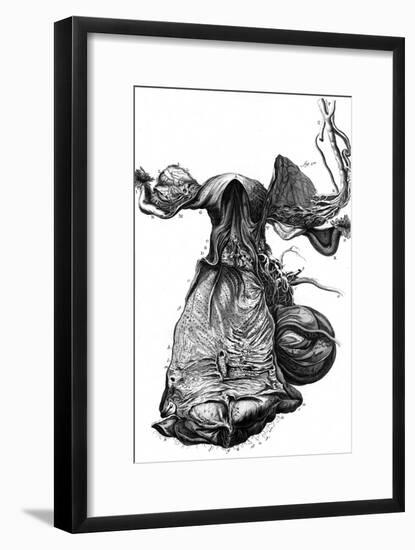 Anatomy, Uterus 18th C.-null-Framed Art Print