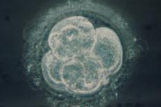 LM of Human Embryo At Four-cell Stage-Andy Walker-Photographic Print