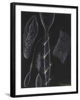 Anemone Stinging Cells-Philip Henry Gosse-Framed Giclee Print