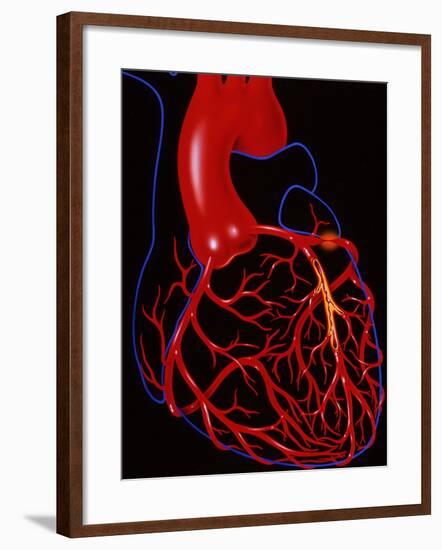 Angina Pectoris-John Bavosi-Framed Photographic Print