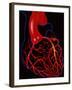 Angina Pectoris-John Bavosi-Framed Photographic Print