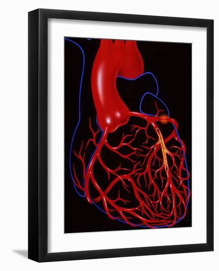 Angina Pectoris-John Bavosi-Framed Photographic Print