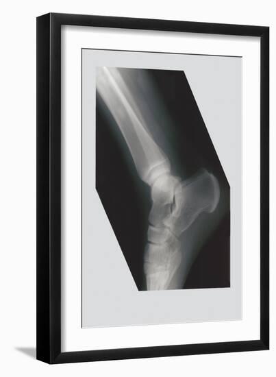 Ankle-null-Framed Art Print