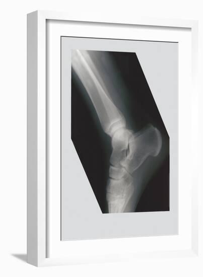 Ankle-null-Framed Art Print