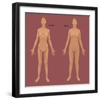 Anorexia Nervosa-Gwen Shockey-Framed Giclee Print
