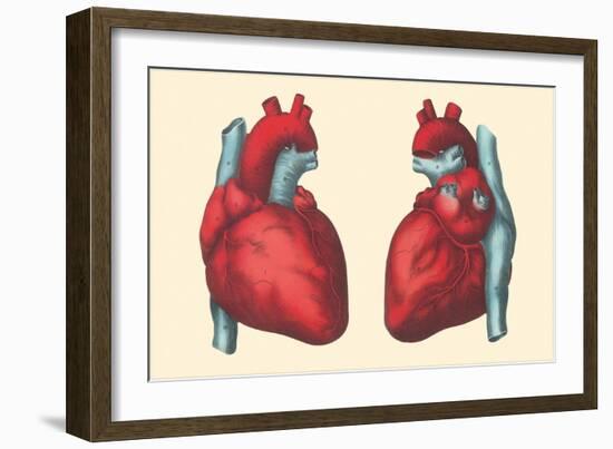 Anterior and Posterior Views of the Heart-Found Image Press-Framed Giclee Print