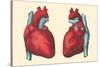 Anterior and Posterior Views of the Heart-Found Image Press-Stretched Canvas