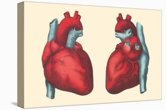 Anterior and Posterior Views of the Heart-Found Image Press-Stretched Canvas