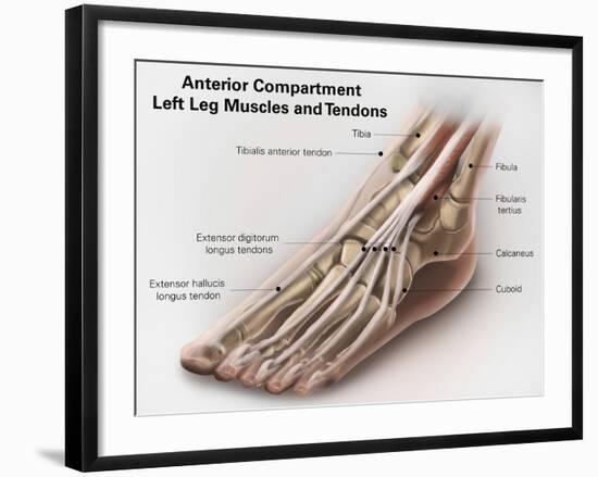 Anterior Compartment Anatomy of Left Leg Muscles and Tendons-null-Framed Art Print