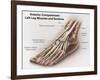 Anterior Compartment Anatomy of Left Leg Muscles and Tendons-null-Framed Art Print