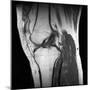 Anterior Cruciate Ligament Tear, CT Scan-Du Cane Medical-Mounted Photographic Print