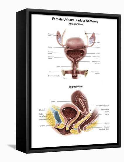 Anterior View and Sagittal View of Female Urinary Bladder-Stocktrek Images-Framed Stretched Canvas